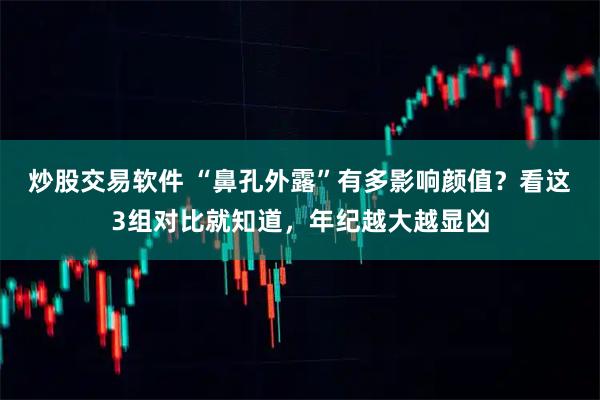 炒股交易软件 “鼻孔外露”有多影响颜值？看这3组对比就知道，年纪越大越显凶